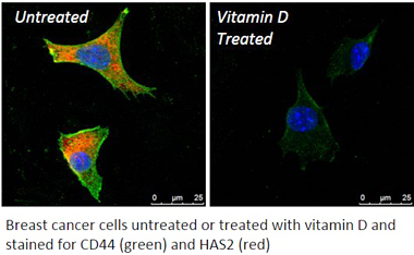 UAlbany Professor JoEllen Welsh's research on Vitamin D