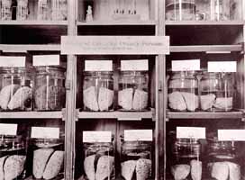 Brains of Educated, Orderly Persons Photograph