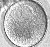 An immature human egg cell, or oocyte
