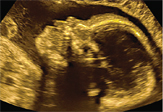 Infant child ultrasound