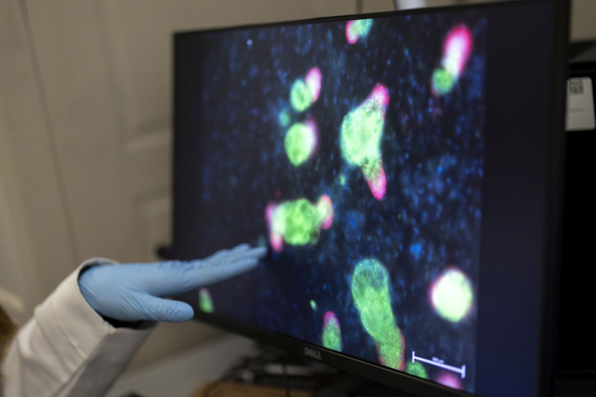 A person wearing blue latex gloves points to a computer screen showing green and red spherical clusters against a black background. 