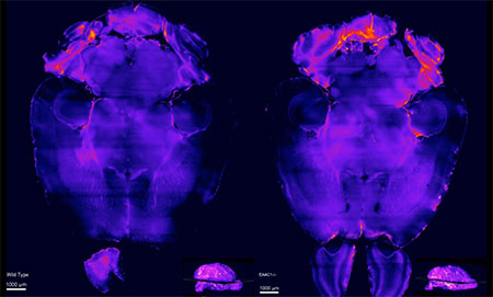 Scan of a mouse brain