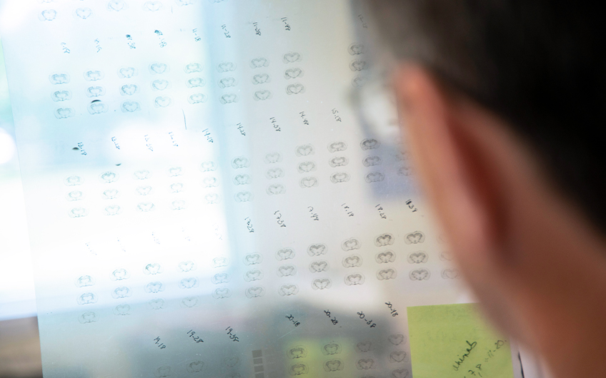 A transparency of illustrations of the brain as seen from over the shoulder of a faculty researcher