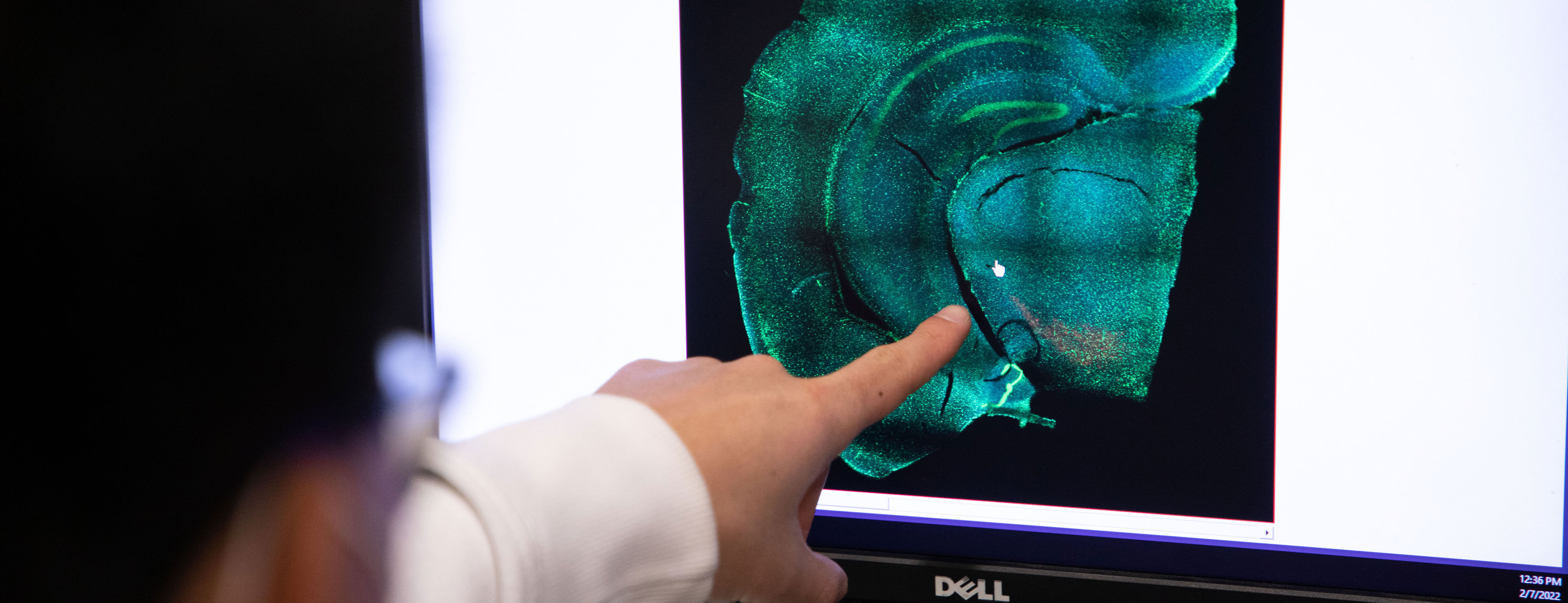 A researcher points to an area on a scan of a human brain shown on a computer screen.