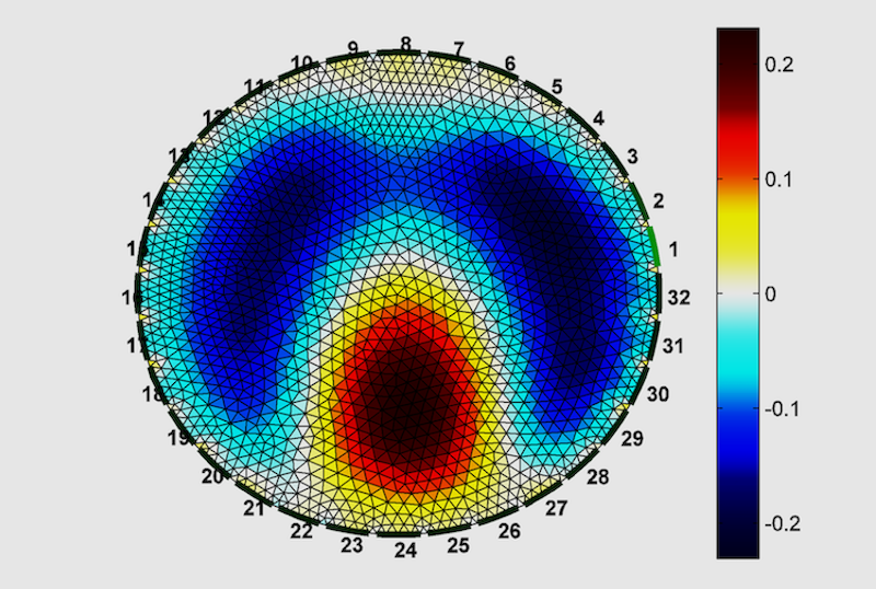 A reconstructed EIT image of the phantom chest