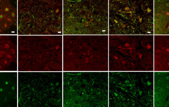 Grid of microscope images of motor neurons
