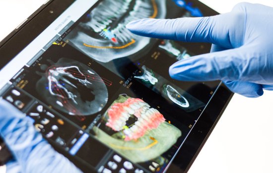 Image shows a tablet displaying digital images of a human mouth, jaw and teeth from different angles. The tablet is being held by a person wearing blue medical gloves. The background is white.