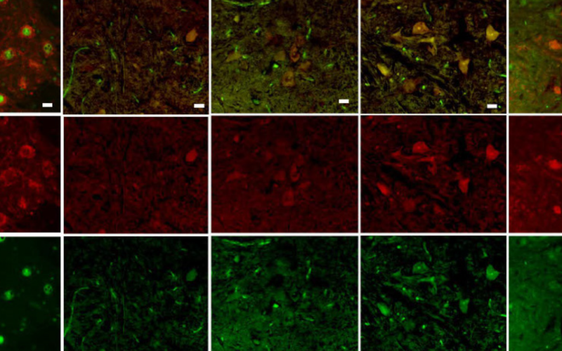 Grid of microscope images of motor neurons
