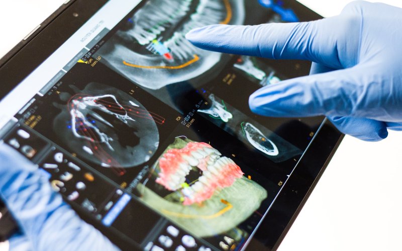 Image shows a tablet displaying digital images of a human mouth, jaw and teeth from different angles. The tablet is being held by a person wearing blue medical gloves. The background is white.