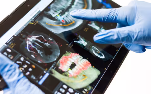 Image shows a tablet displaying digital images of a human mouth, jaw and teeth from different angles. The tablet is being held by a person wearing blue medical gloves. The background is white.