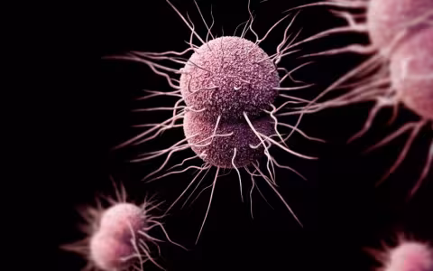 Image of gonorrhea cells