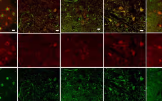 Grid of microscope images of motor neurons