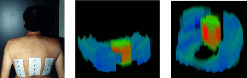 3-D EIT images showing the heart and lungs