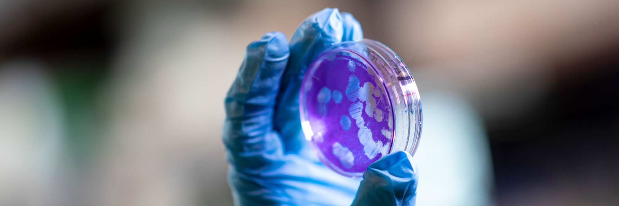 A hand wearing blue PPE gloves holds up a Petri dish with purple agar and clear spots.