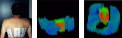 3-D EIT images showing the heart and lungs