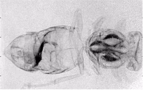 X-ray of an insect.