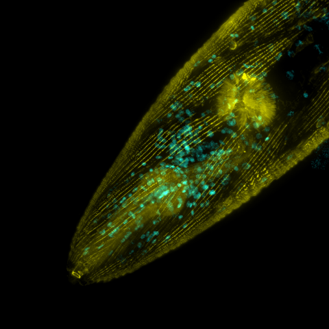 Microscope image of a c. elegans head, visible as yellow fluorescent spear-shaped outline, dotted with blue-green speckled against a black background.