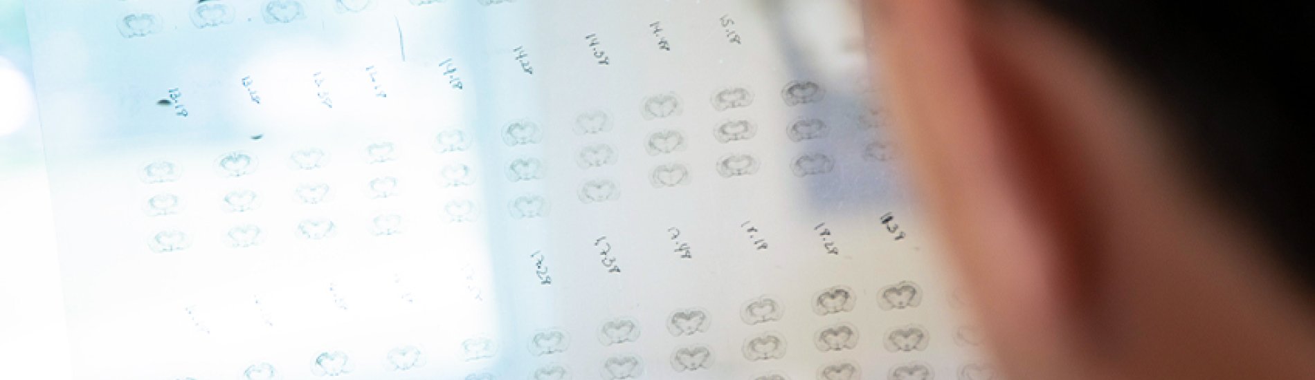 A transparency of illustrations of the brain as seen from over the shoulder of a faculty researcher